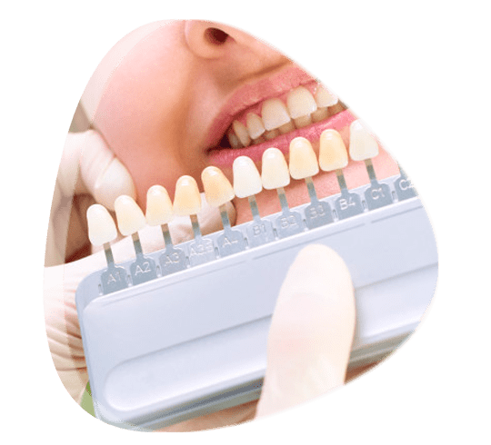 Cita con especialista en prótesis bucal en Tlalnepantla de Baz