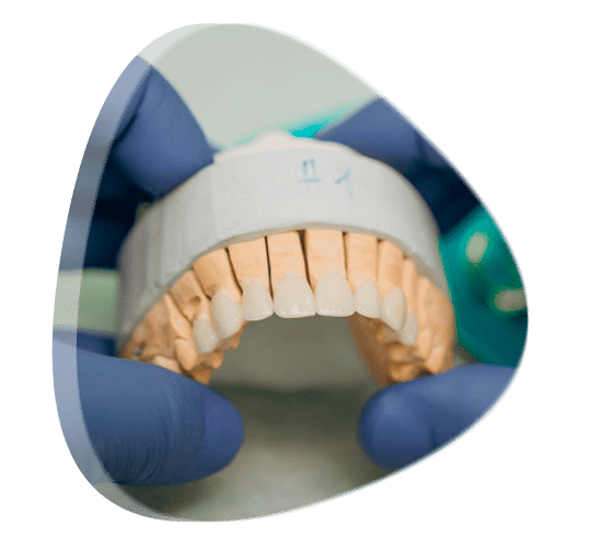 Doctores especialistas en prótesis bucal en Tlalnepantla de Baz