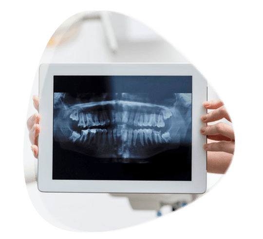 Prótesis bucal en Tlalnepantla de Baz