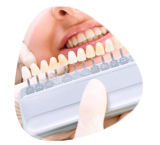 Prótesis bucal profesional en Tlalnepantla de Baz